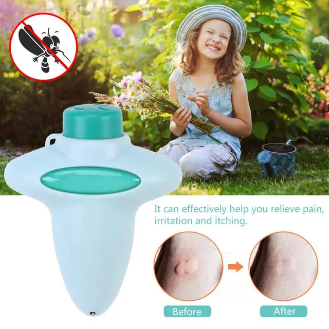 Harapáscsökkentő Eszköz Harapások És Csípések Eltávolító Bőr Nyugtató A Viszketés Duzzanat Csökkentése Érdekében Beltéri Kültéri Kempingben - Image 5