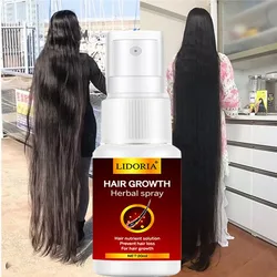 Hair Growth Serum Spray Fast Liquid Treatment Scalp Follicle Anti Loss Natural Beauty Health Care
