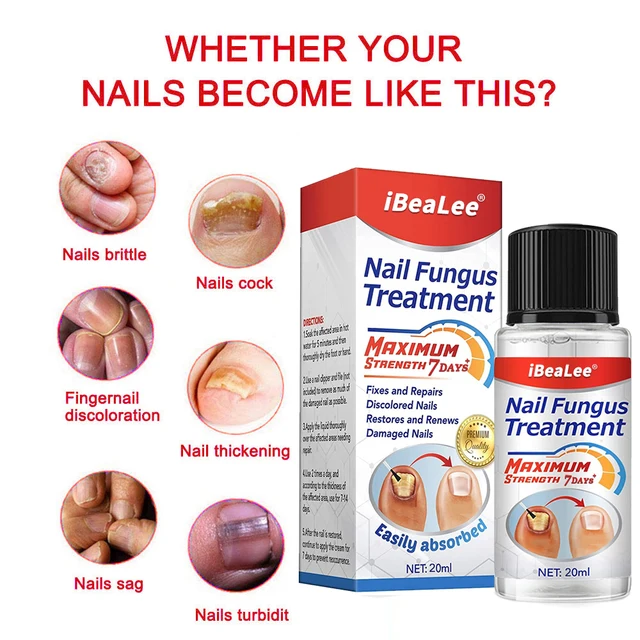 Ibealee days fungus nail treatment serum hand foot nails repair care toe fungal removal cream anti