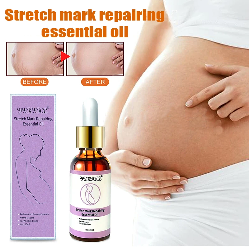 Óleo de tratamento, óleo de estiramento para cuidados com a pele, reparação de cicatriz maternidade, melhorar a elasticidade