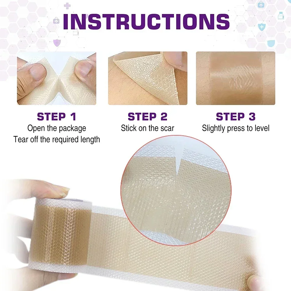 1Roll Silicone Scars Sheets Keloid Bump Removal Strips,Scars Reducing Treatments Surgical Scars,Burn,Tummy Tucks,Acne,C-Section