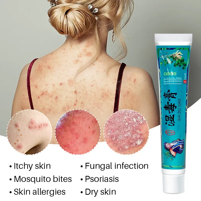 1Pcs Psoriasis Cream Skin Care Herbal Plaster Dermatitis Eczematoid Eczema Urticaria Treatment Ointment Relieve Skin Itch S068