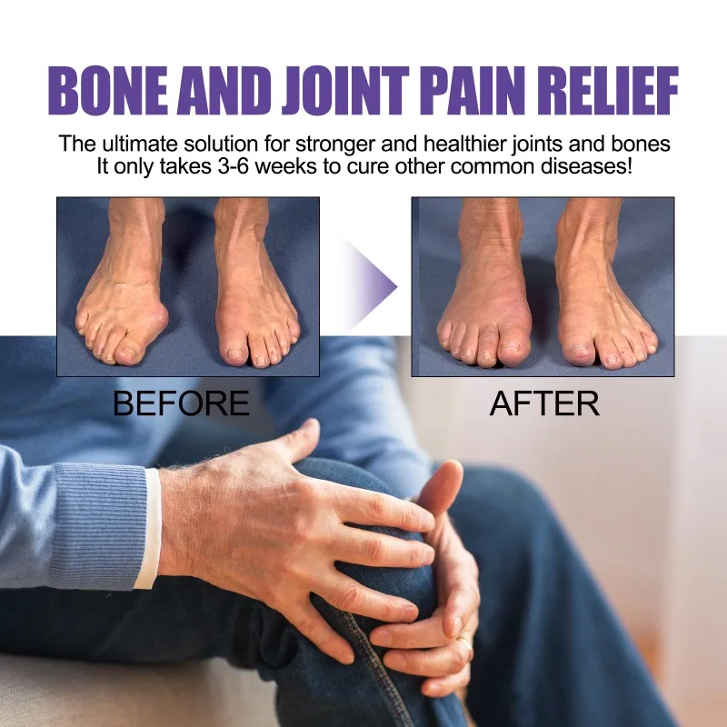 Chinese herbal mugwort extract mugwort knee cream treat spinal pain and knee joint pain massage care cream 50g