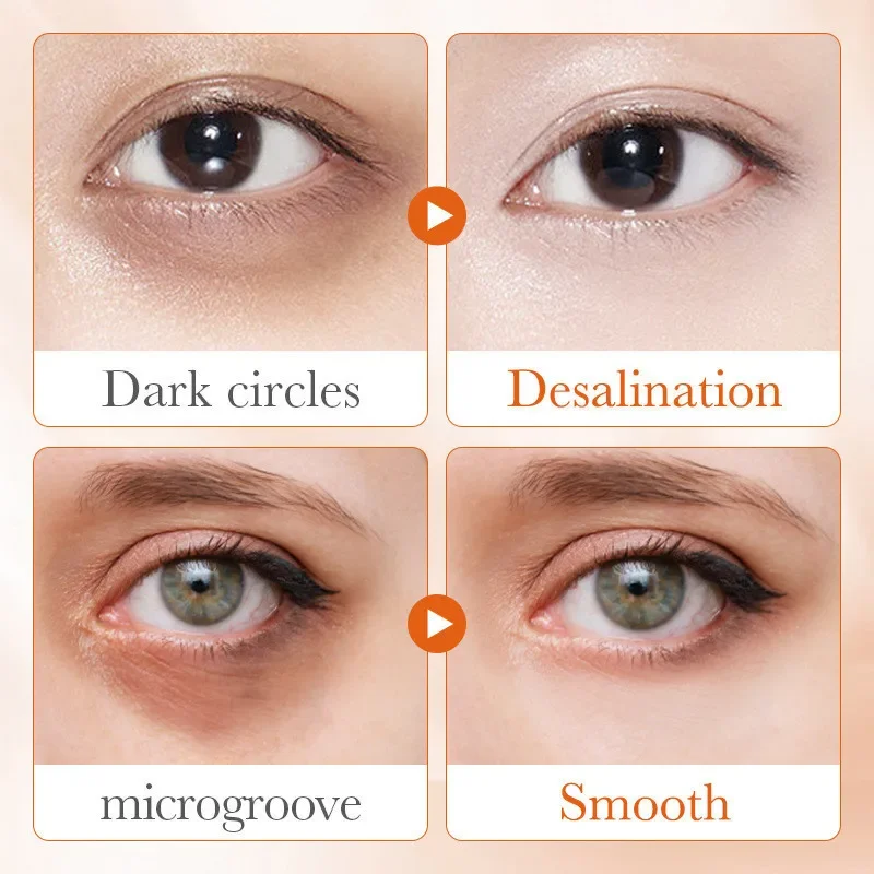 Eye area before and after
