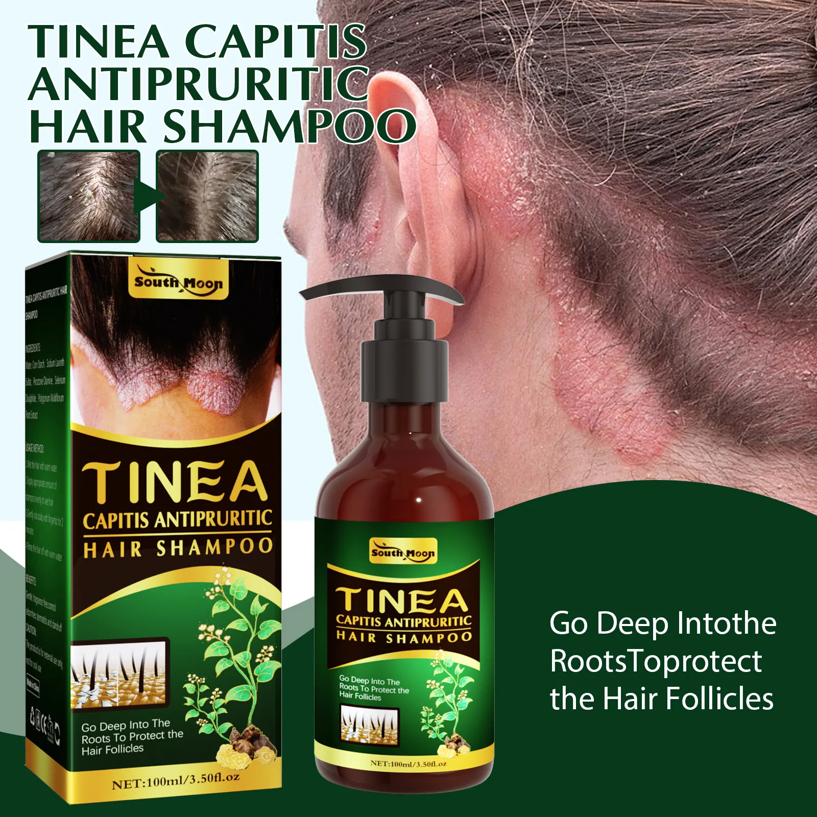 South Moon Tinea Capitis Antipruritic Hair Shampoo Scalp Anti dandruff