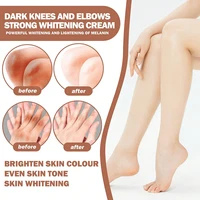 Dark colored knees and elbows effectively brighten and fade, enhancing even skin tone 2