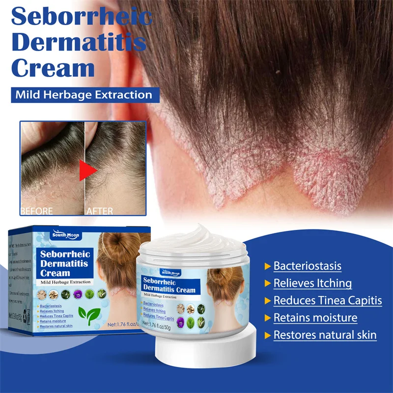 Psoriasis cabello, de cuidado de la piel seborreica, Dermatitis, Eczema, cabeza, acné, prurito, cuero cabelludo, reparación, cuero cabelludo, elimina la caspa - AliExpress