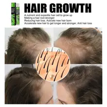 

1/3/5PCS Grey Hair Treatment Serum Hair Growth Spray Restoration Black Hair Anti Hair Loss White Hair Repair Hair Loss Product
