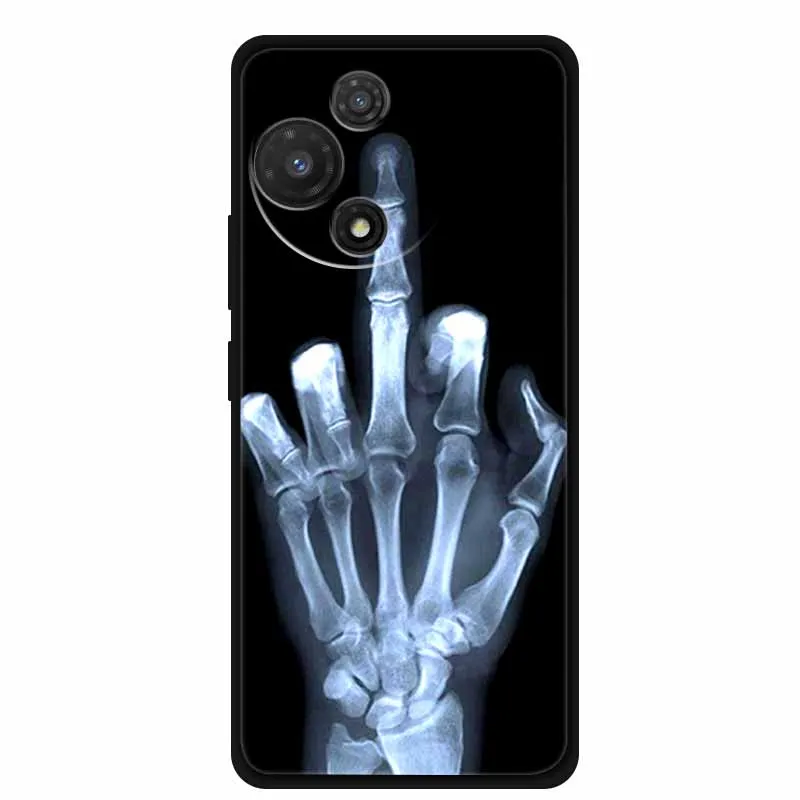 Black Soft Silicone TPU Phone Case with Cool Wolf Design - Shockproof and Protective Cover