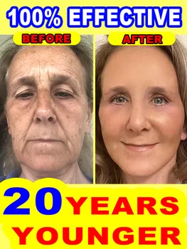 Advanced Anti-Wrinkle Face Cream – 1