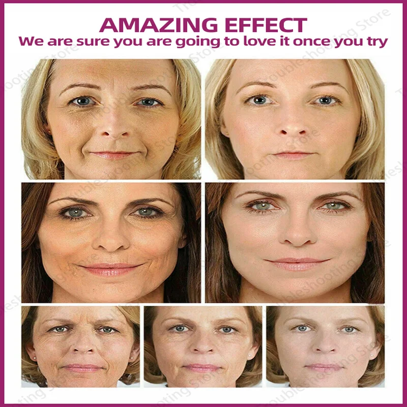 Rimpel Remover Gezicht Serum Anti Aging Lifting Verstevigende Vervagen Fijne Lijntjes Essentie Hydraterende Voedende Huidverzorging Koreaans_voghion.com
