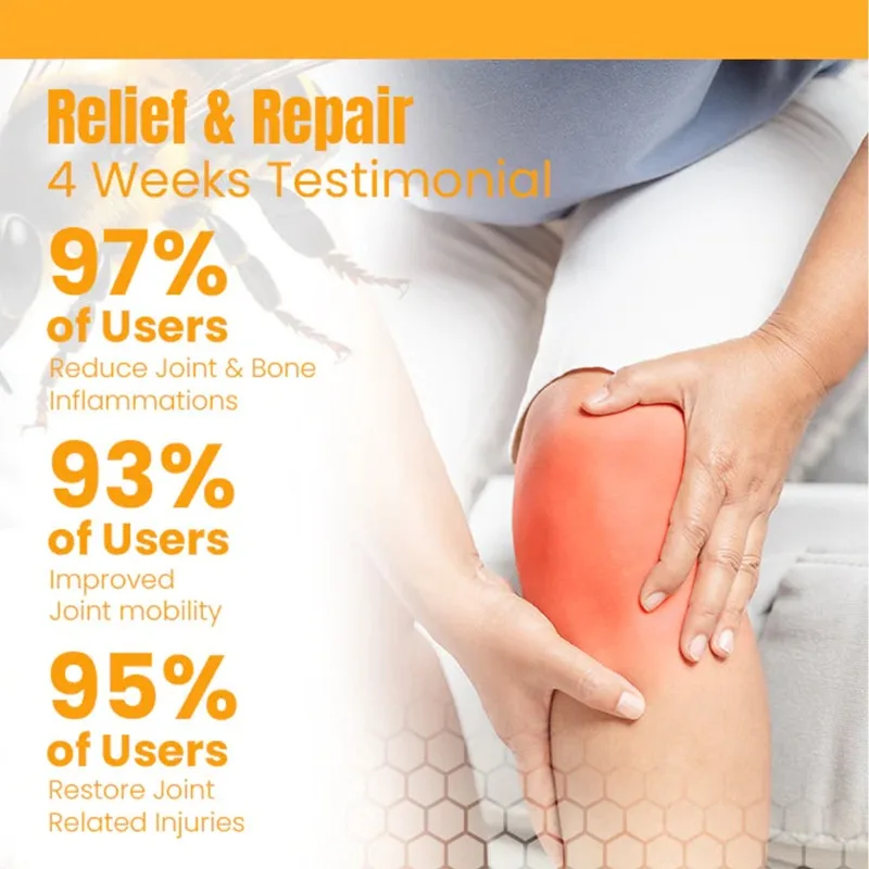 Bee Venom New Zealand Treatment Gel Cream Relieve Muscle Joint Pain for Legs Hands Arms Feet Health Care