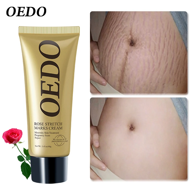 Stretch Mark Cream Rose Removes Stretch Mark Cream for Women