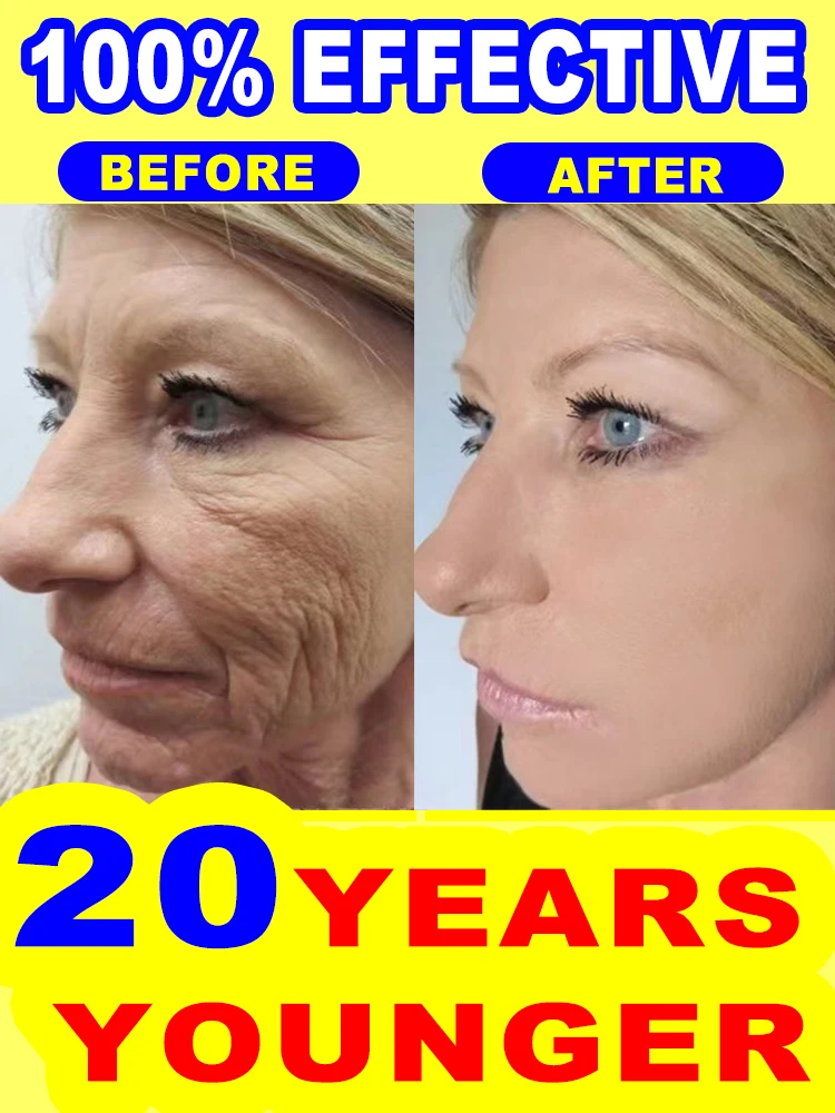 wrinkles disappeared