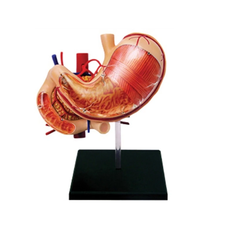 

Медицинская модель желудка и поджелудочной железы человека, инструмент для обучения анатомии патологии желудка