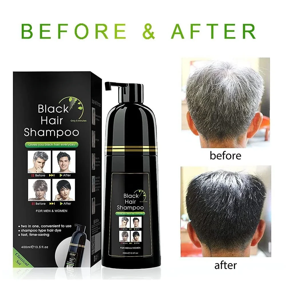 400ml 1pcs Plant Hair Dye Dyeing Protecting Covering White Hair Combing Black Men and Women Natural Black Dyeing Cream hair dye shampoo,hair dye pen