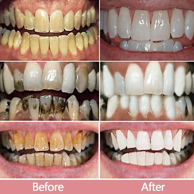 Teeth Whitening Product Teeth Whitening Essence Toothpaste Serum Remove Plaque Stains Oral Hygiene Cleaning Dental Bleaching Tools Fresh Breath Tooth Care