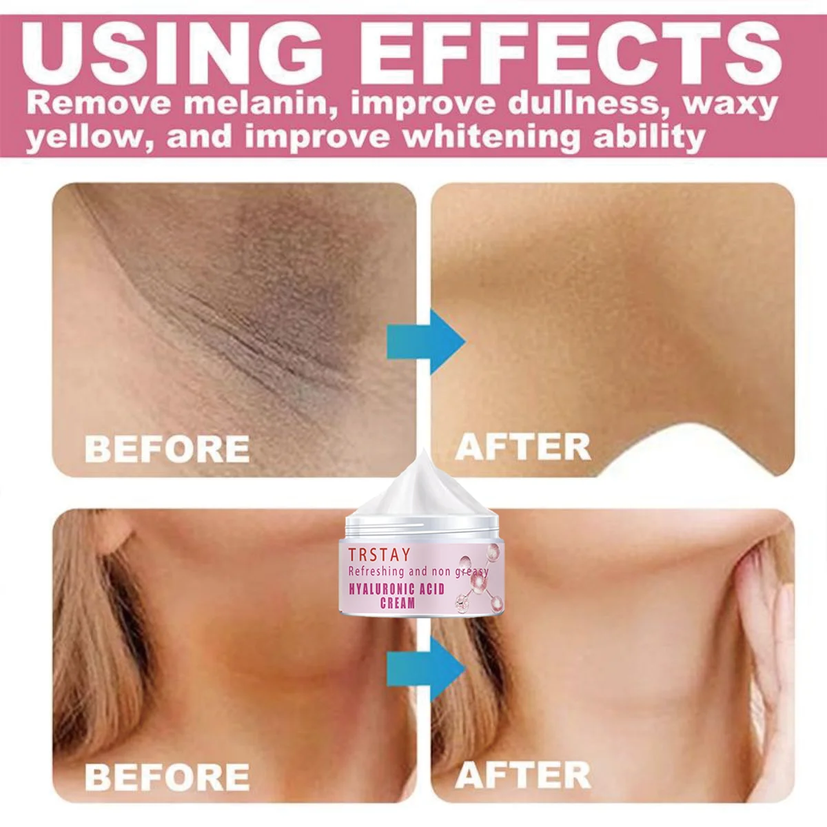 Body Lightening Cream Skincare Face Body Whitening for Sensitive Areas