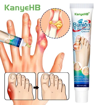 1Pcs Herbal Foot Gout Cream Thumb Corrector Finger Hallux Ointment Toe Bunion Foot Pain Relieve Medical Plaster Health Care G019