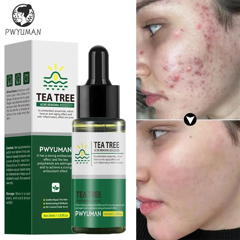 

PWYUMAN Tea Tree Acne Treatment Facial Serum Repair Spots Scar Oil Control Pimples Remove Gel Shrink Pore Moisturizing Skin Care