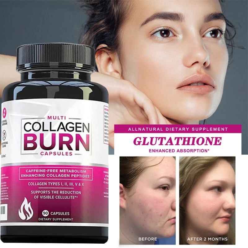 60 Pills Collagen Peptide Capsules Eliminate Fat Masses Wrinkles