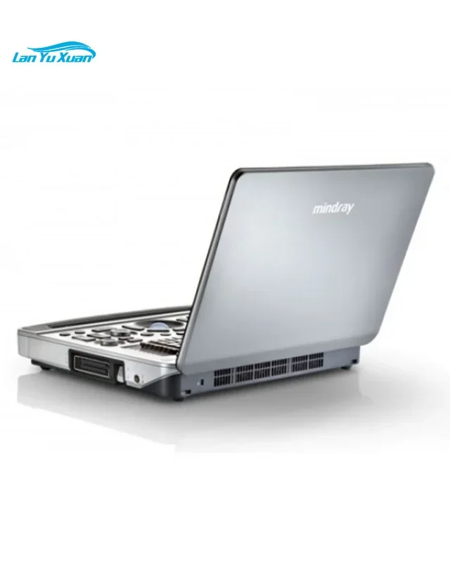 Рисунок 3 - Портативный ультразвуковой аппарат