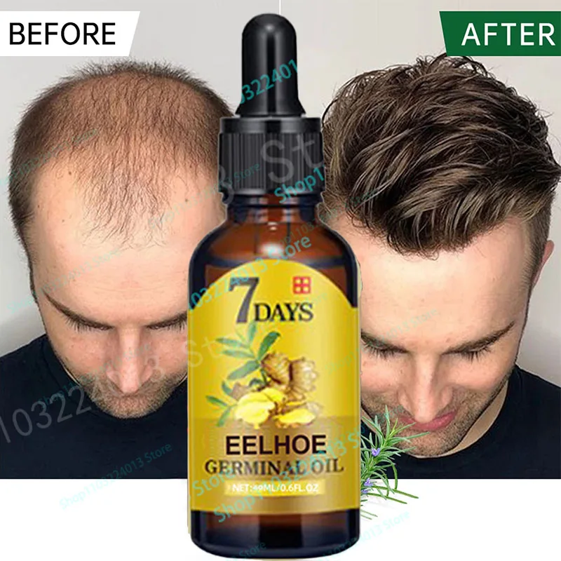 

Ginger Hair Growth Product Anti Hair Loss Serum Liquid Fast Grow Prevent Baldness for Men Women Hair Care Essential Oil