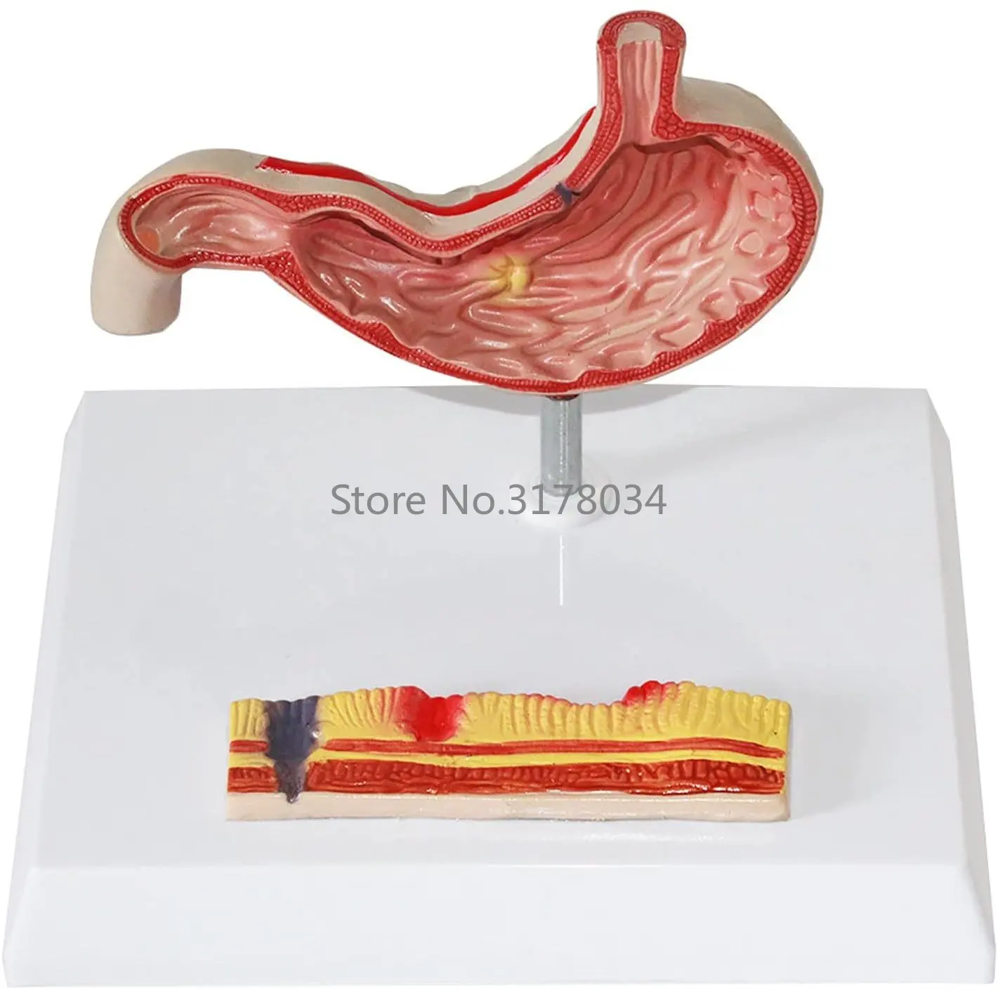 

PVC Human Stomach Anatomical Showing Model with Base - Medical Anatomy Study Display Model Kit 18 x 13 x 17 cm