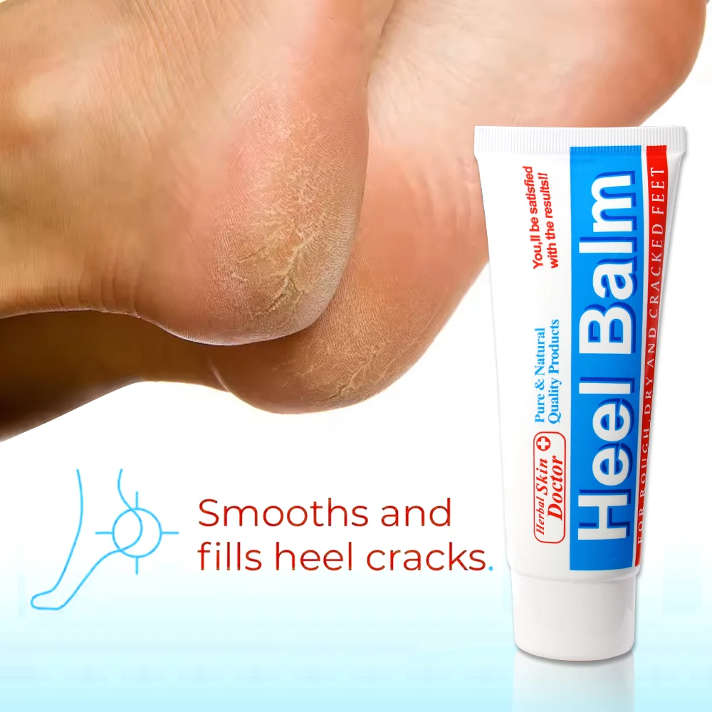 Herbal Frostbite Crack Foot Cream Oil Feet Foot Cream for Extremely Dry Cracked Feet Instantly Boosts Moisture Levels