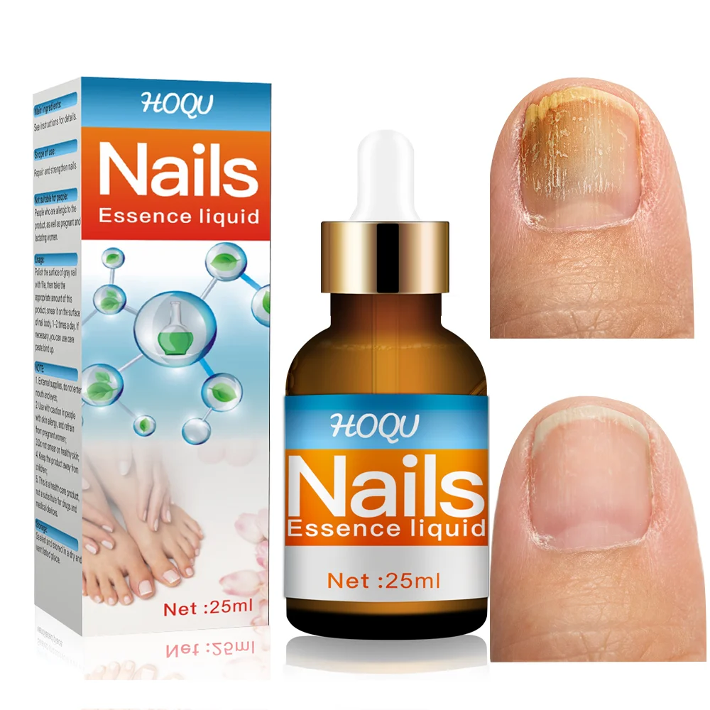 

For Repair Nail Fungal Anti Infection 7Days Treatment Feet Nails Fungus Removal Gel Cuticle Oil Foot Care Beauty Health Essence