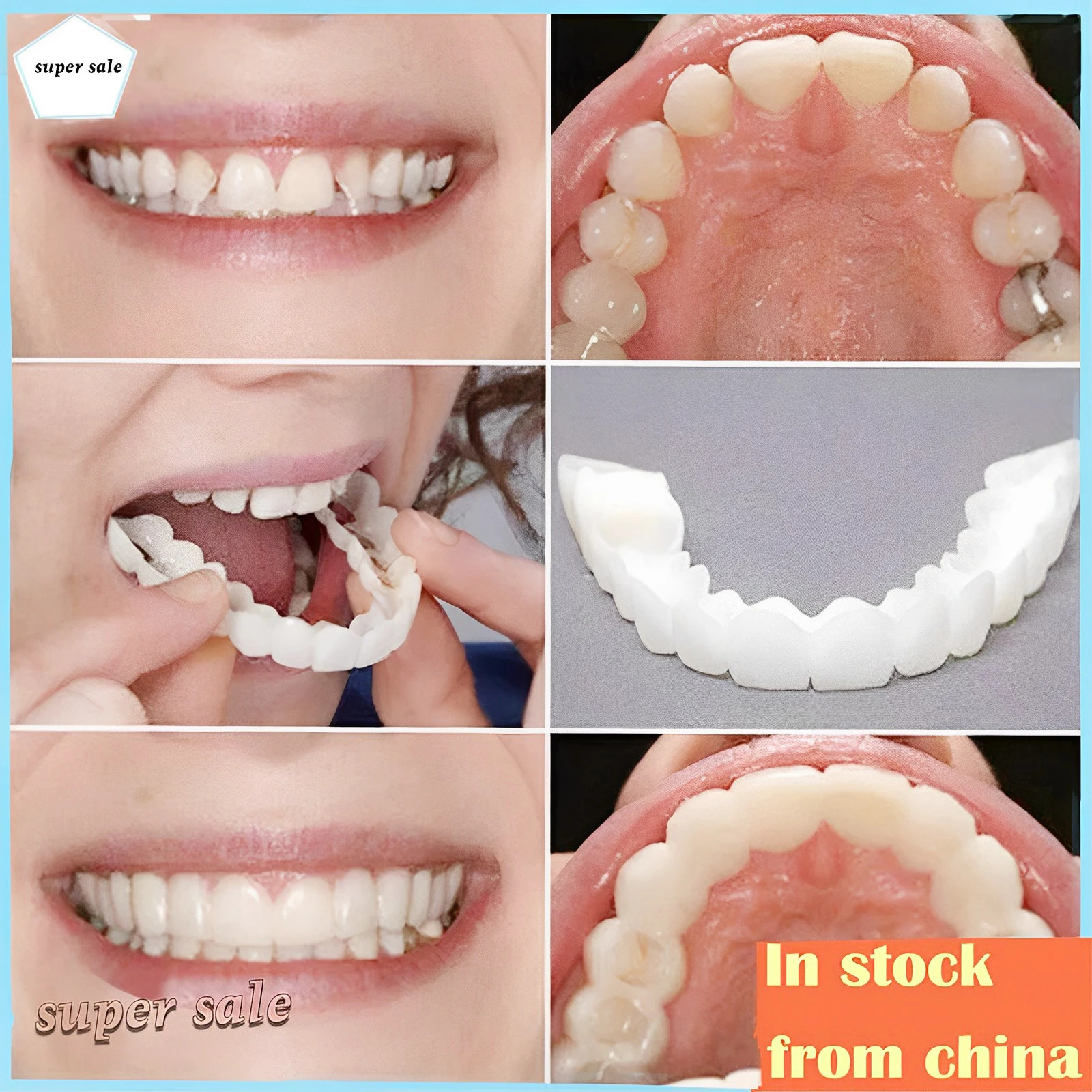 10/20/30g denti finti colla solida resina protesi adesiva denti Set di  riparazione denti temporanei Silicone denti finti dente finto superiore -  AliExpress