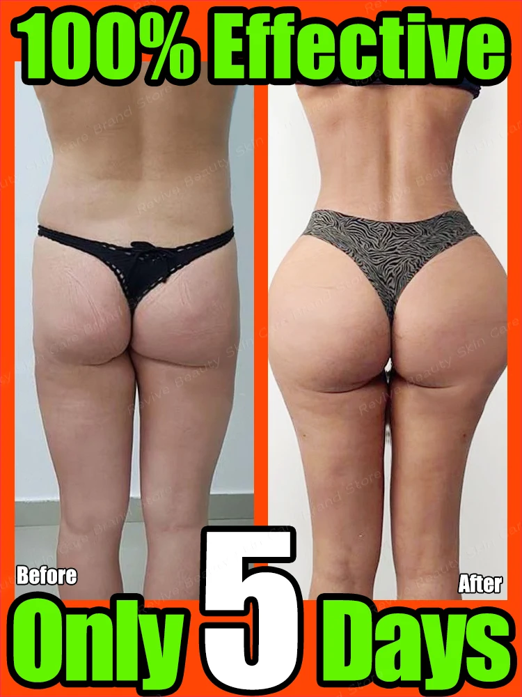 Buttock Enlargement Oil Butt Lift Up Firming Big Hip Enhance Increase