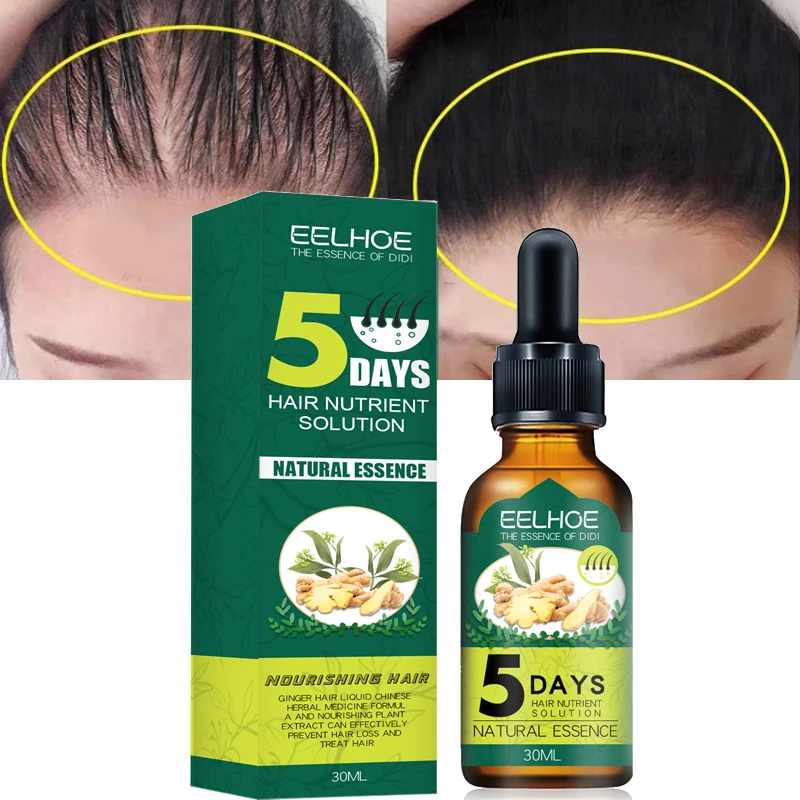 5 Days Ginger Hair Care Essential Oil Hair Growth Natural Solution Anti