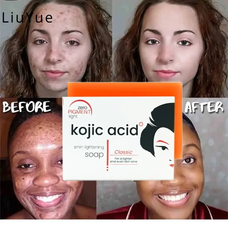 

Kojic Acid Soap Cleansing Gentle Skin Nourishing Moisturizing Dry Skin Improving Melasma Lightening Melanin Papaya Care Soap