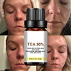 Face Care Exfoliating Radiant Skin Fade Dark Spots & Pigmentation for Even Brighter Skin Remove Spots Arm Knee Legs Melanin