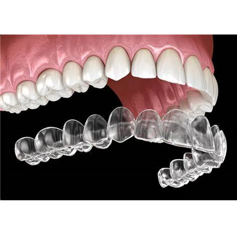 Фото Силиконовый гель Invisalign, гигиенические Стоматологические Ортодонтические приборы для зубов, Ортодонтические приборы, оборудование для выравнивания зубов №3
