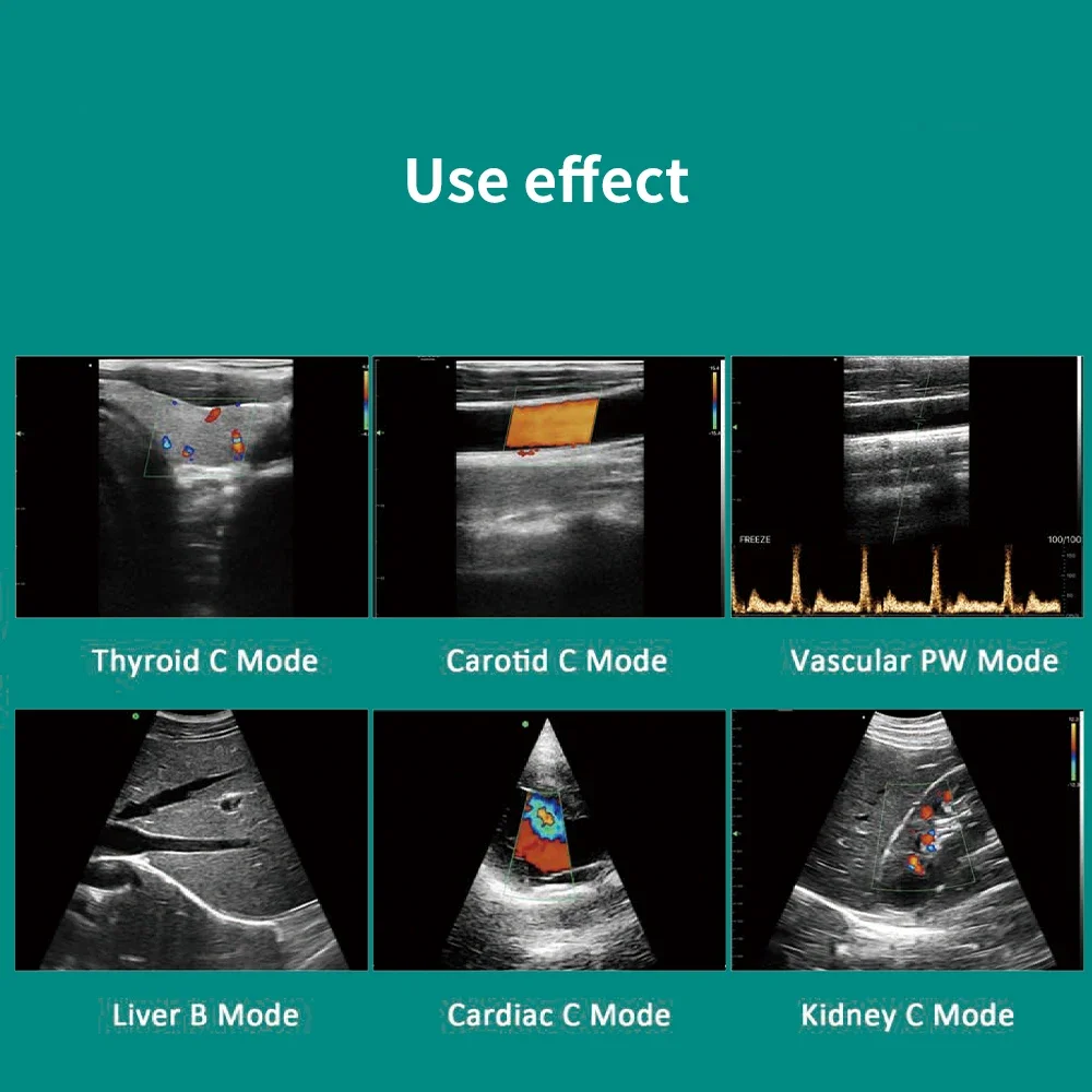 Wireless Ultrasound Scanner Dual Head Convex + Linear + Cardiac Preset 3 in 1 Probe C10RL