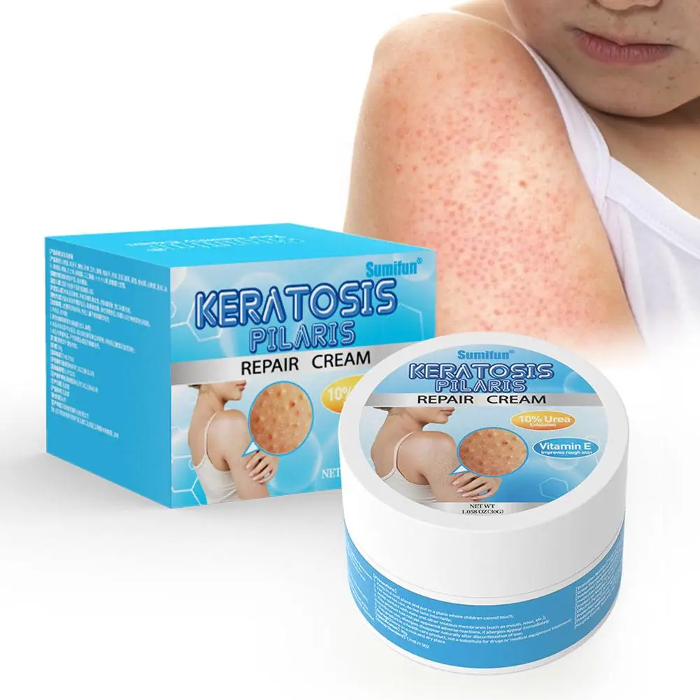 

Средство для ухода за кожей с витамином Е, клубникой, крем для кожи с курицей для удаления Keratins, отбеливающий и увлажняющий уход O9D5