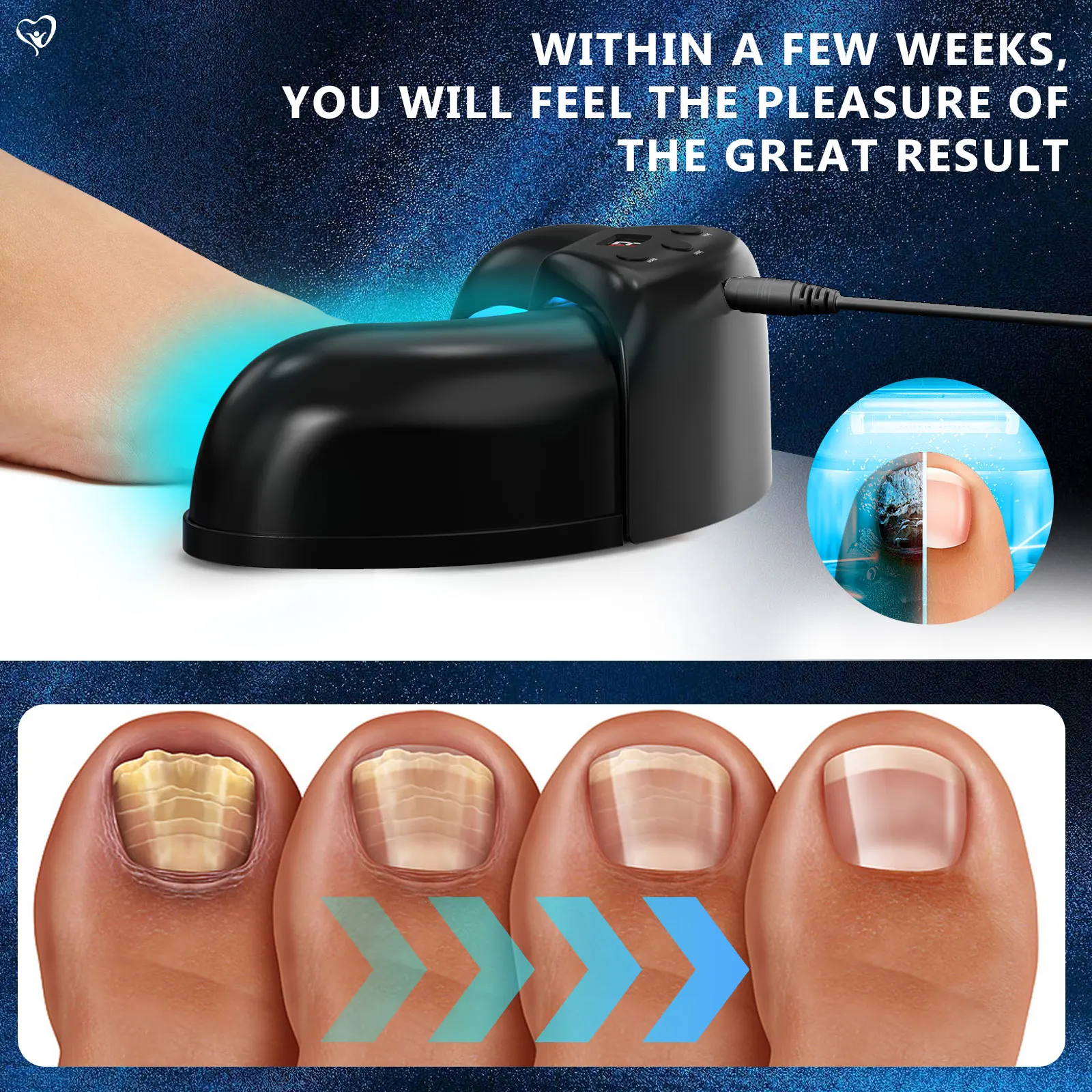 Nail Fungus Remover Personal Health Care 905nm470nm 7Minutes Painless Laser for Multiple Toenail Nail Fungus&Ingrown toenail equipment
