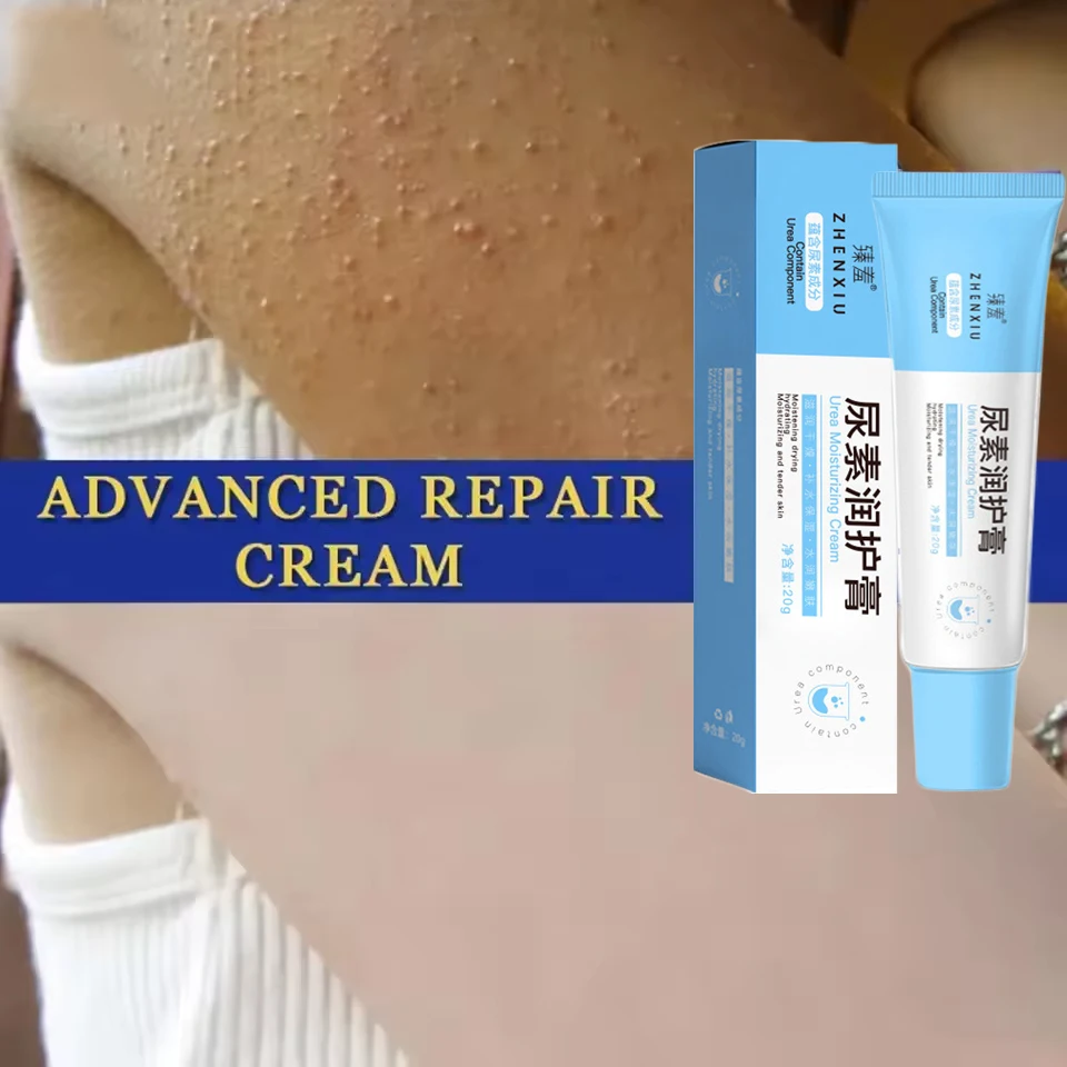 New Chicken Skin Repair Cream Curing Keratosis Follicle Pilaris Remove Thick Pores Body Dark Spot Moisturize Smooth Skin Care 3