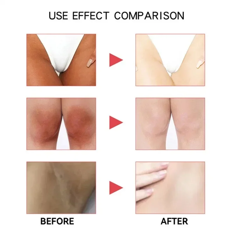 Inner Thigh Brightening Cream Private Parts Lighten Cream Intimate Area Armpit Knee Bleach Emulsion Underarm Brighten Skin Care 5