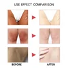 Inner Thigh Brightening Cream Private Parts Lighten Cream Intimate Area Armpit Knee Bleach Emulsion Underarm Brighten Skin Care 5