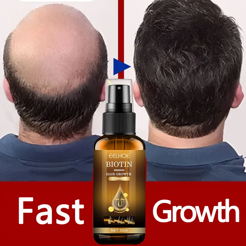 

Eelhoe Fast Hair Growth Products For Men Women Hair Loss Treatment Eyelashes Eyebrows Beard Growth Hair Care Solution Spray 30ml