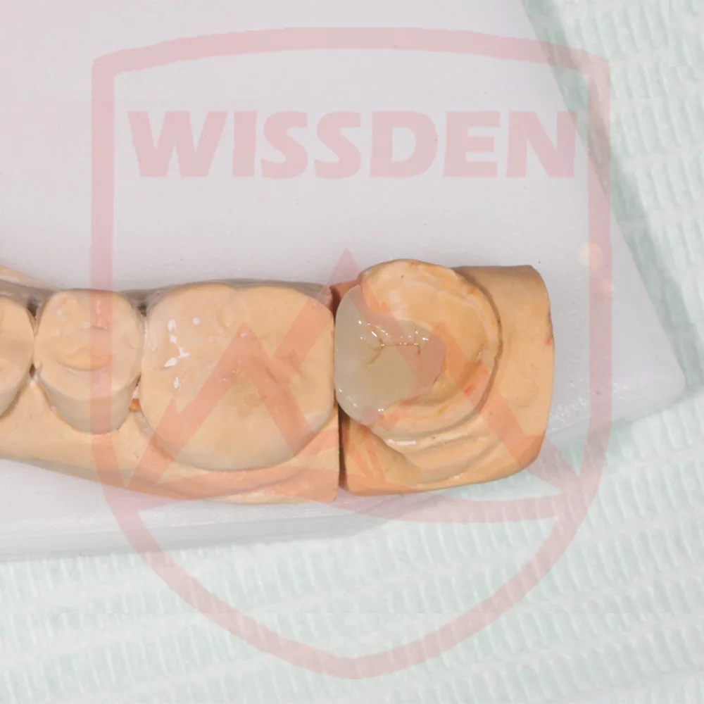 Wissden 5 Pieces Dental Glass Ceramic Press Lithium Disilicate Ingots Dental Lab Materials Same day dispatch can be arranged 3