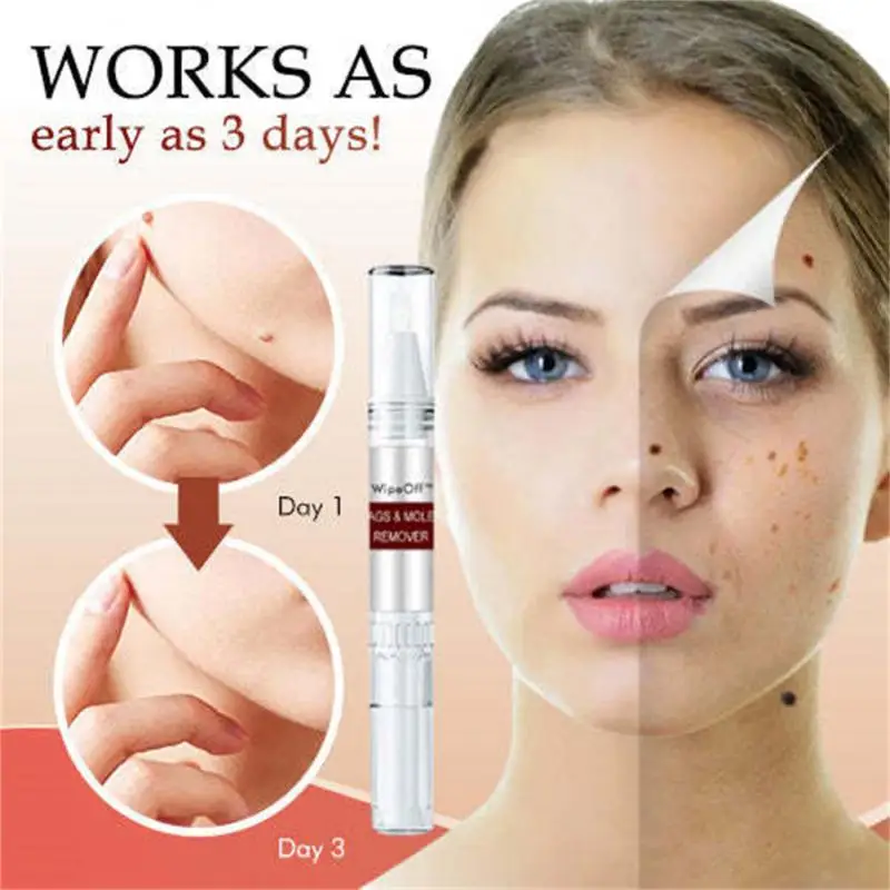 

Wart Pen WipeOff Tags Moles Remover Waterproof Lasting Tag Remover Pen Makeup Comestics Tools Concealer Whitening Skin Care