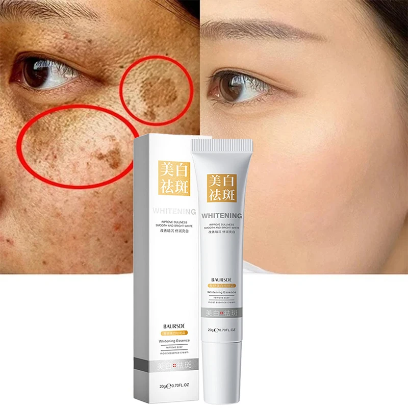 

Effective Whitening Freckles Cream Remove Dark Spots Fade Melanin Anti-Pigmentation Improve Dullness Fast Brighten Skin Care 20g