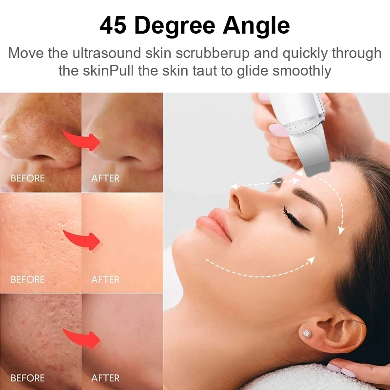 Facial Cleaner Xiaomi Youpin Ultrasonic Skin Scrubber Peeling Blackhead Remover Face Lifting Exfoliating