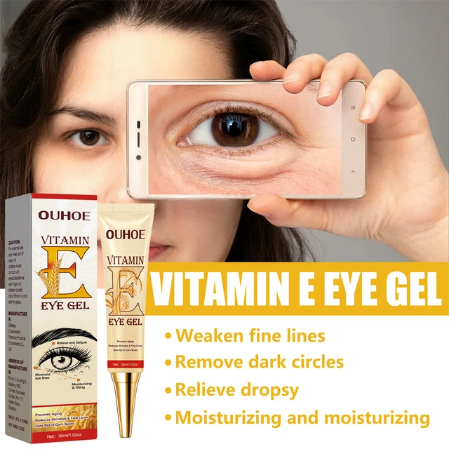 Details more than 149 vitamin e for eye bags super hot kidsdream.edu.vn