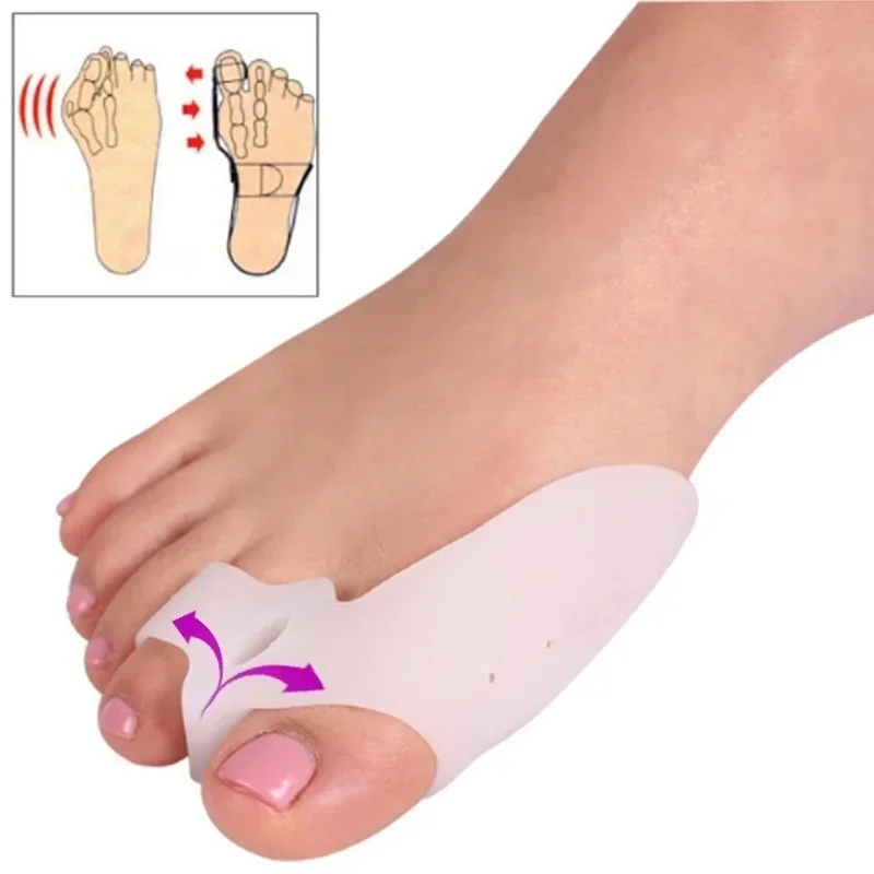 1 Pair Two-hole Toe Orthosis toe separators toe spreader ingrown toenail corrector toe corrector finger toe separator toe protectors