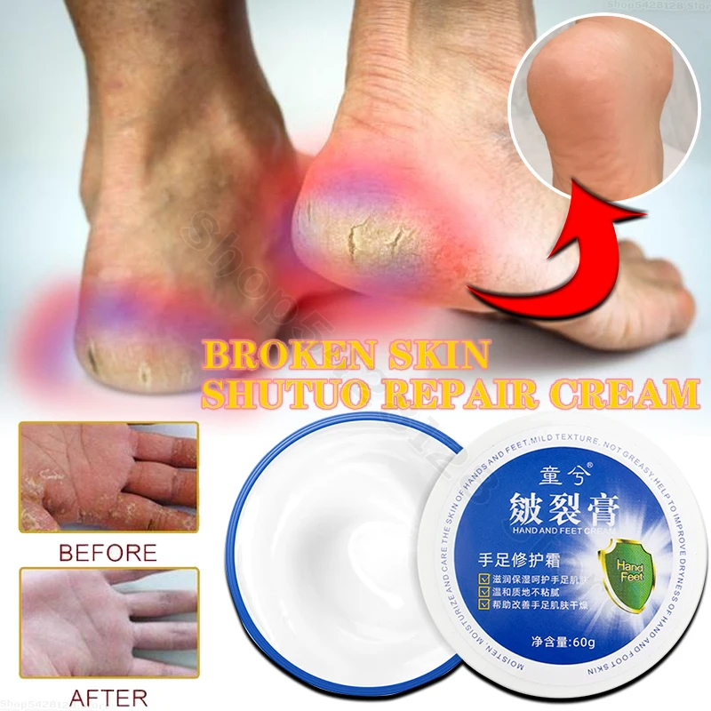 

Vaseline Moisturizing Anti-Cracked Foot Cream Cracked Heels Repair Cream Exfoliating Hands and Feet Care Delicate Skin 60g
